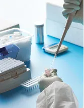 Infectious Disease Diagnostics Market Analysis North America, Europe, Asia, Rest of World (ROW) - US, Germany, China, UK, Canada - Size and Forecast 2024-2028