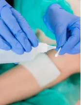 Bioactive Wound Dressing Market Analysis North America, Europe, Asia, Rest of World (ROW) - US, Germany, France, UK, Japan - Size and Forecast 2024-2028