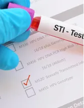 Sexually Transmitted Diseases (STD) Treatment Market Analysis North America, Europe, Asia, Rest of World (ROW) - US, Japan, China, Germany, UK - Size and Forecast 2024-2028