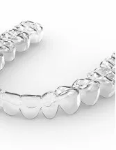 Dental Braces Market Analysis North America, Europe, Asia, Rest of World (ROW) - US, Germany, UK, Canada, China - Size and Forecast 2024-2028