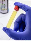 Toxicology Testing Market Analysis North America, Europe, Asia, Rest of World (ROW) - US, Canada, UK, Germany, China - Size and Forecast 2024-2028