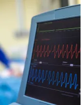 Vital Signs Monitoring Devices Market Analysis North America, Europe, Asia, Rest of World (ROW) - US, Germany, China, UK, Japan - Size and Forecast 2024-2028