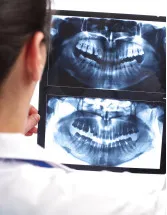 Dental Imaging Market Analysis North America, Europe, Asia, Rest of World (ROW) - US, China, Germany, France, Japan - Size and Forecast 2024-2028