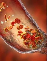 Pulmonary Arterial Hypertension (Pah) Drugs Market Analysis North America, Europe, Asia, Rest of World (ROW) - US, UK, Germany, Canada, Japan - Size and Forecast 2024-2028