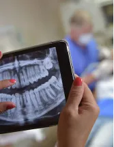 Dental X Ray Market Analysis North America, Europe, Asia, Rest of World (ROW) - US, Germany, Japan, China, Canada - Size and Forecast 2024-2028