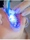 Dental Curing Lights Market Analysis North America, Europe, APAC, South America, Middle East and Africa - US, China, Germany, Japan, France - Size and Forecast 2024-2028