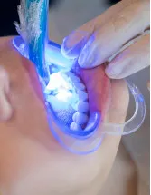 Dental Curing Lights Market Analysis North America, Europe, APAC, South America, Middle East and Africa - US, China, Germany, Japan, France - Size and Forecast 2024-2028