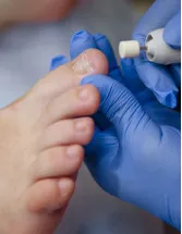 Onychomycosis Treatment Market Analysis North America, Europe, Asia, Rest of World (ROW) - US, Germany, UK, China, Japan - Size and Forecast 2024-2028