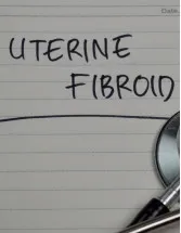 Uterine Fibroid (Uf) Treatment Device Market Analysis North America, Europe, Asia, Rest of World (ROW) - US, Japan, Germany, China, Canada - Size and Forecast 2024-2028