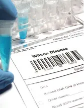 WilsonS Disease (WD) Drugs Market Analysis North America, Europe, Asia, Rest of World (ROW) - US, Germany, UK, Canada, China - Size and Forecast 2024-2028