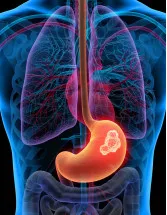 Gastric Cancer Drugs Market Analysis North America, Europe, Asia, Rest of World (ROW) - US, Germany, UK, China, Canada - Size and Forecast 2024-2028