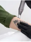 Tattoo Removal Market Analysis North America, Europe, APAC, South America, Middle East and Africa - US, China, Germany, Canada, UK - Size and Forecast 2024-2028