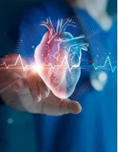 Cardiovascular Information System (CVIS) Market Analysis North America, Europe, Asia, Rest of World (ROW) - US, Canada, China, Germany, Mexico - Size and Forecast 2024-2028