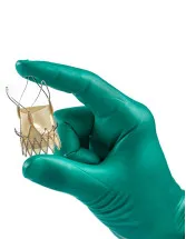 Transcatheter Aortic Valve Replacement Market Analysis North America, Europe, Asia, Rest of World (ROW) - US, UK, Germany, China, France - Size and Forecast 2024-2028