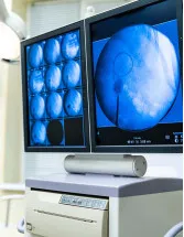 US - Medical Display Monitors Market by Type, Technology and Application - Forecast and Analysis 2024-2028