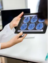 Neurodiagnostics Market Size, Share & Trends [2024-2028 Report]