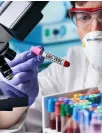 Hematology Analyzers and Reagents Market Analysis North America, Asia, Europe, Rest of World (ROW) - US, Canada, Germany, China, Japan - Size and Forecast 2024-2028