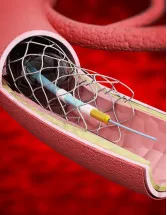 Interventional Radiology Products Market Analysis North America, Europe, Asia, Rest of World (ROW) - US, Germany, China, UK, Japan, Canada, India, France, Australia, South Korea - Size and Forecast 2024-2028