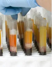 Blood Plasma Market Analysis North America, Europe, Asia, Rest of World (ROW) - US, Germany, France, China, Canada, UK, Japan, Brazil, India, Italy - Size and Forecast 2024-2028