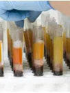 Blood Plasma Market Analysis North America, Europe, Asia, Rest of World (ROW) - US, Germany, France, China, Canada, UK, Japan, Brazil, India, Italy - Size and Forecast 2024-2028