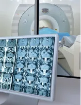 Clinical Trial Imaging Market Analysis North America, Europe, Asia, Rest of World (ROW) - US, China, Germany, UK, Japan, India, France, Canada, Australia, Brazil - Size and Forecast 2024-2028