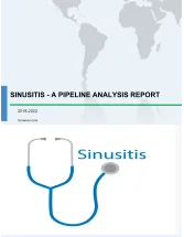 Sinusitis - A Pipeline Analysis Report