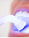 Teeth Whitening Market Analysis APAC, North America, Europe, South America, Middle East and Africa - US, India, China, Germany, Japan, Canada, UK, France, Brazil, Spain - Size and Forecast 2025-2029