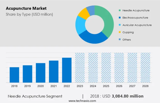 Acupuncture Market Size