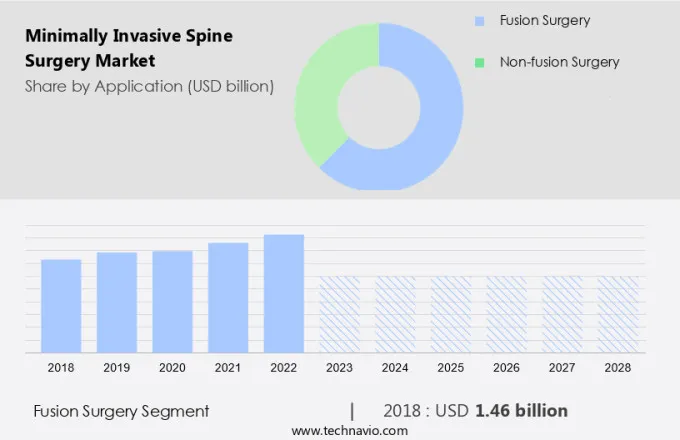 Minimally Invasive Spine Surgery Market Size