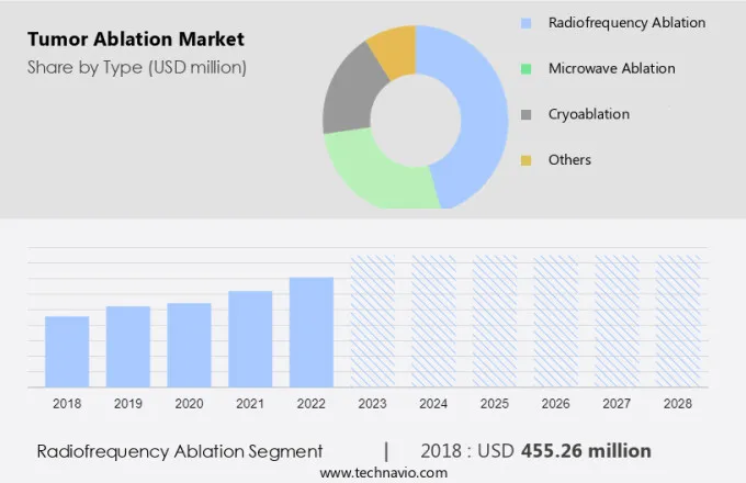 Tumor Ablation Market Size